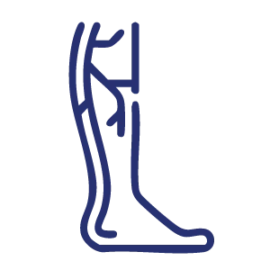 Cirugia vascular y tradicional de várices