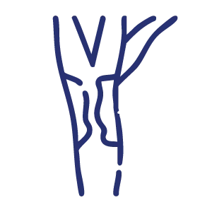Enfermedad carotidea